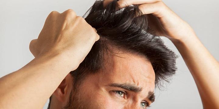 Causes of Hair Loss in Teenage Males